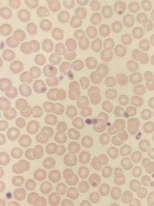 正常な血液の顕微鏡写真